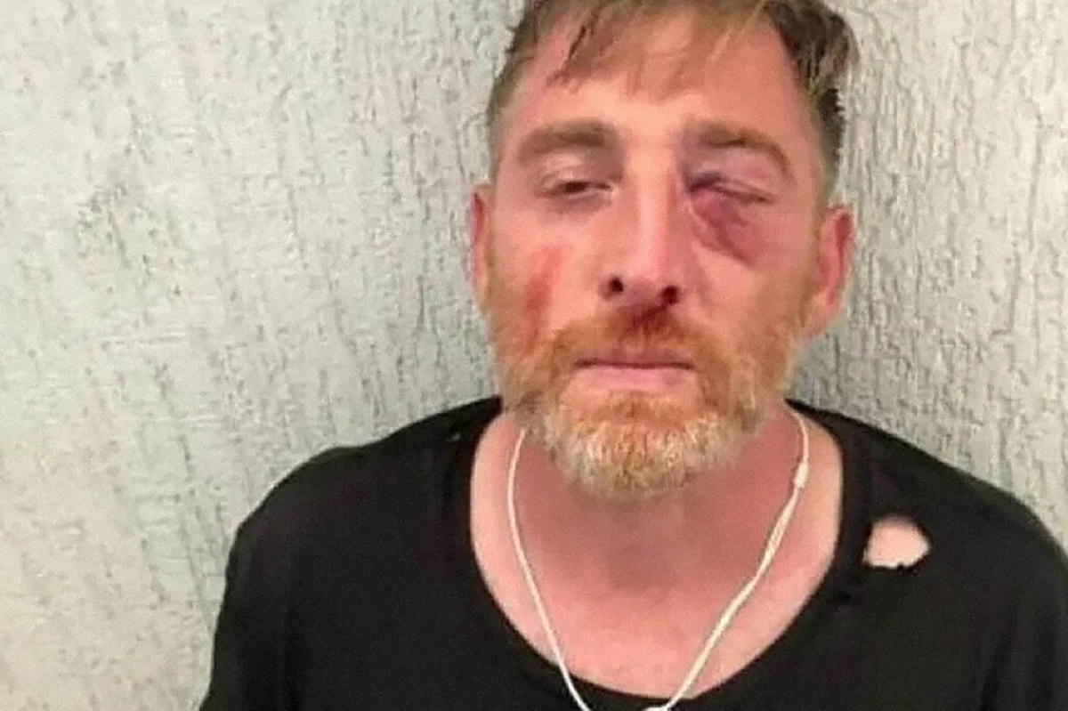 Homofobik saldırıda öldürülen gazetecinin otopsisi beş aydır yapılamadı